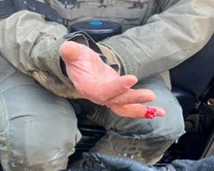 St. Paul Woman Indicted by a Minnesota Federal Grand Jury for inflicting Bodily Injury on a Federal Law Enforcement Officer in the Performance of His Official Duties